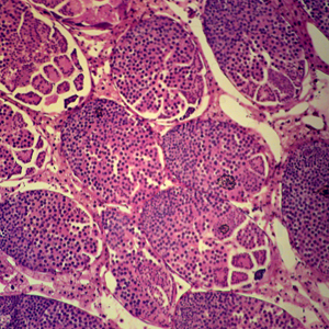 상품 섬네일 상품 섬네일